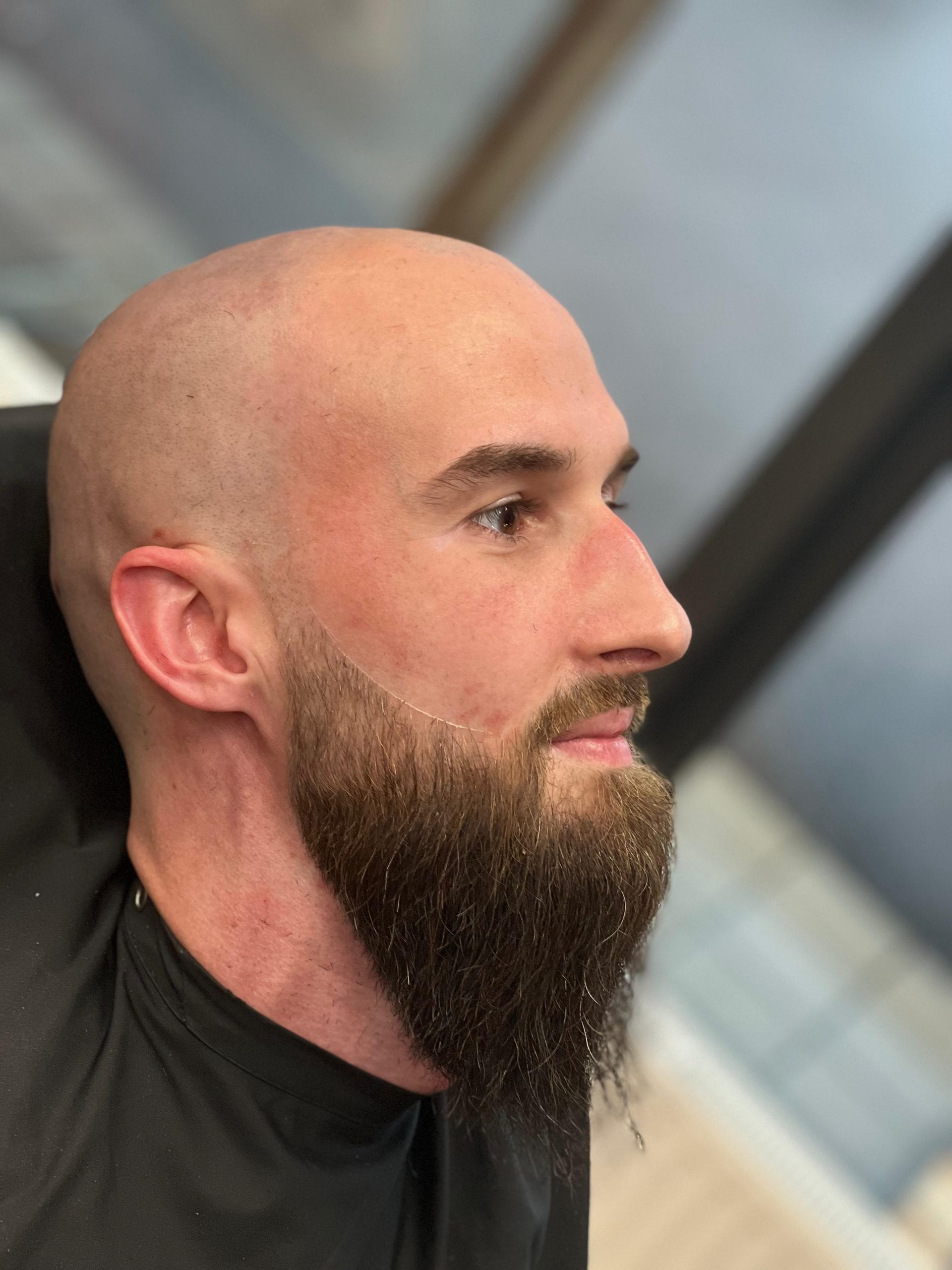 Nachher: Glatze & Vollbart Pflege – Onkel Fade Barbershop Graz